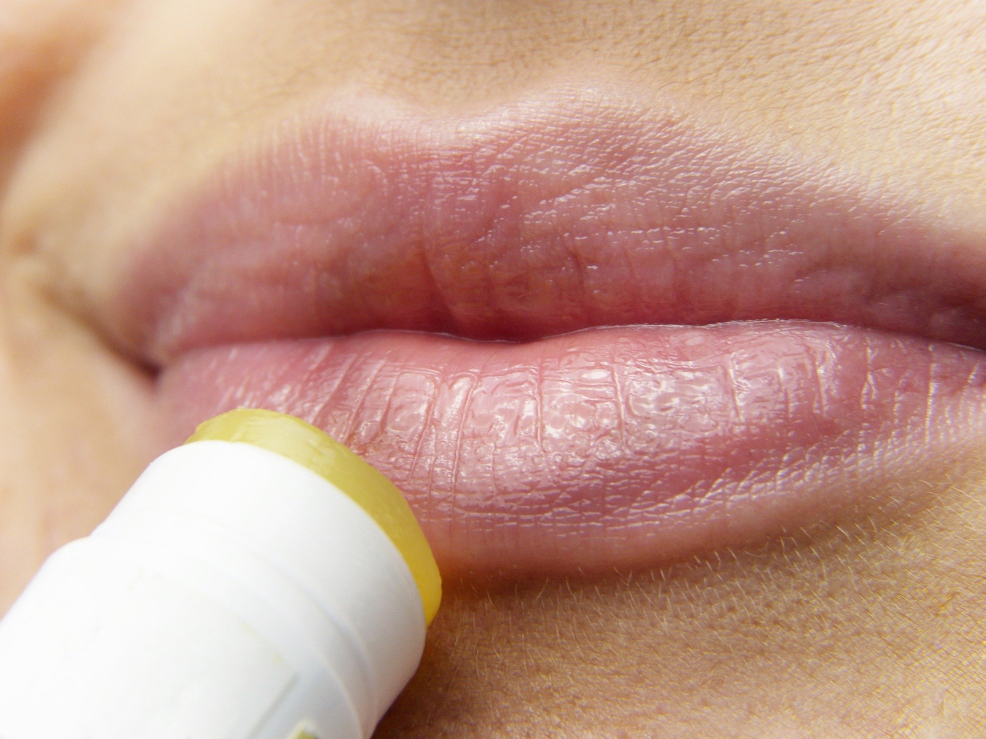 rencontres herpes